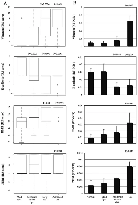 figure 4. Vimentin, E-cadherin, BMI1 and ZEB1 protein expression according to the (A) IRS and (B) mRNA expressions