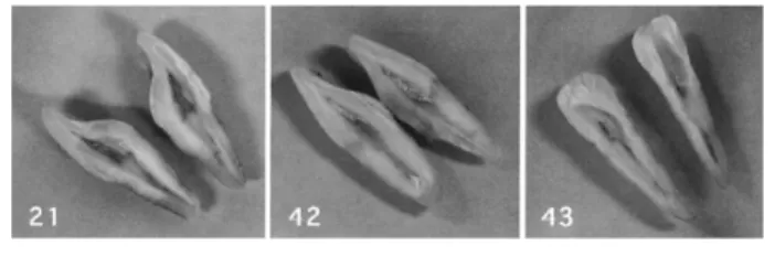 Fig. 4 Teeth used for serological test