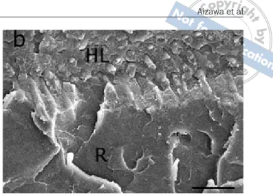 Fig 1a SEM micrograph of fractured dentin side after tensile bond strength testing (uniform irradiation at 100-10)