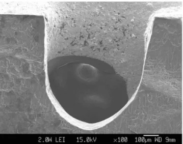 FIG. 7.  Morphologic presentation of a cut section by SEM,  showing a typical bowl type ablation at 100 mJ/pulse and  20 pps in the 2.0-W group