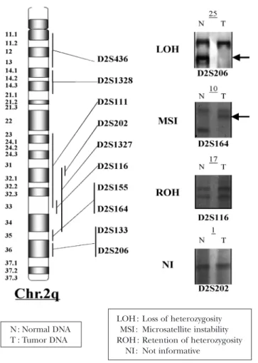 Fig. 2 Typical examples of allelic imbalances (LOH and MSI) on 2q