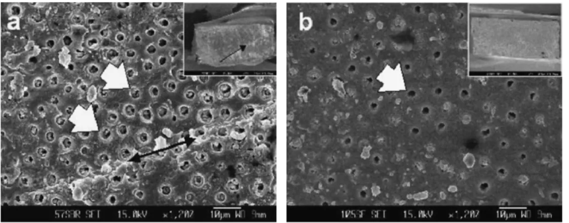 Fig. 4 Representative SEM images of fractured surfaces on dentin side after microtensile bond strength test (a) Adper Single Bond/regular, 23.3 MPa; (b) Adper Single Bond/superfine, 11.2 MPa