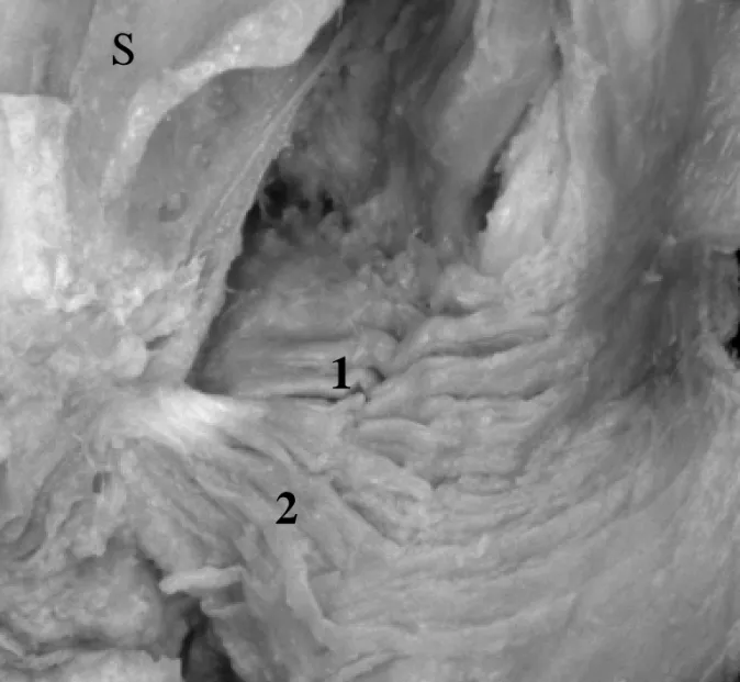 Fig. 2. Pterygopharyngeal part of the superior pharyngeal constrictor muscle as  observed from the posterolateral side.
