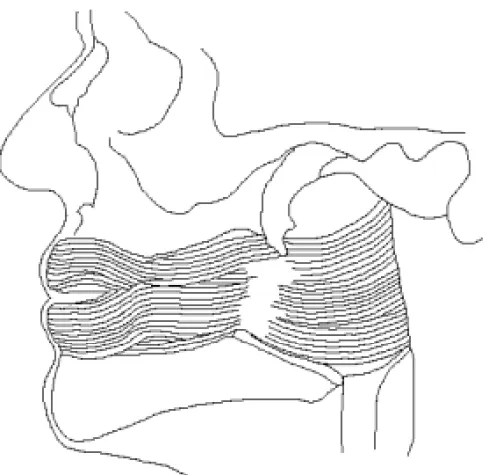 Fig. 3. Type I as observed from the facial (lateral) side