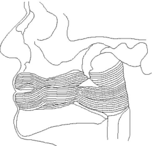 Fig. 4. Type II as observed from the facial (lateral) side