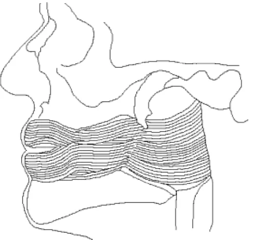 Fig. 5. Type III as observed from the facial (lateral) side