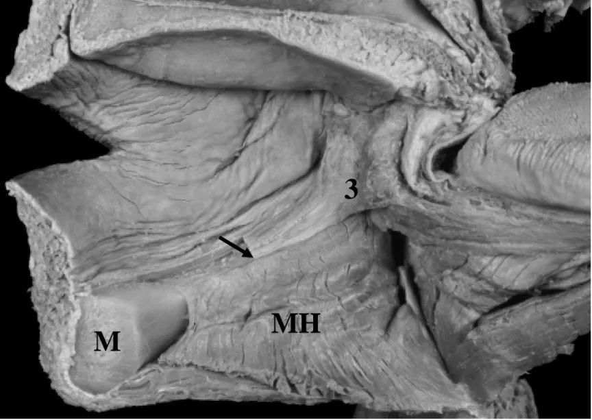 Fig. 8. Morphology of the origin of the mylopharyngeal part (Type I)
