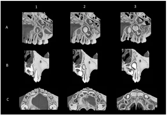Fig.  2  Micro-CT image of Stage I