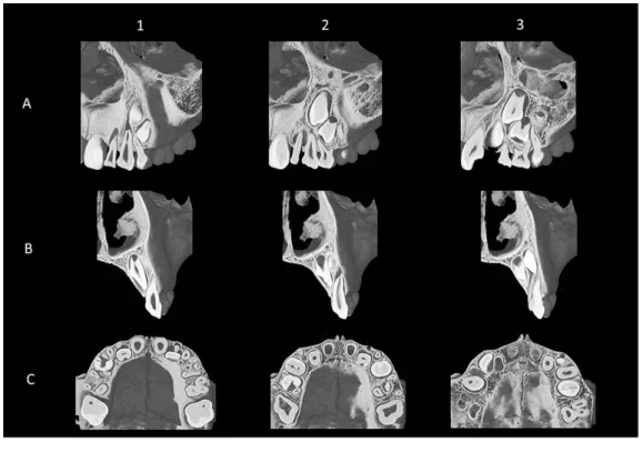 Fig.  4  Micro-CT image of Stage III