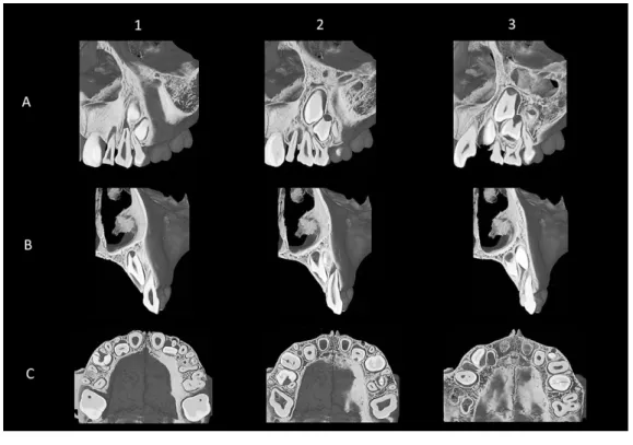 Fig.  4  Micro-CT image of Stage III