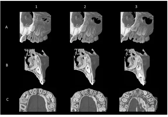 Fig.  5  Micro-CT image of Stage IV