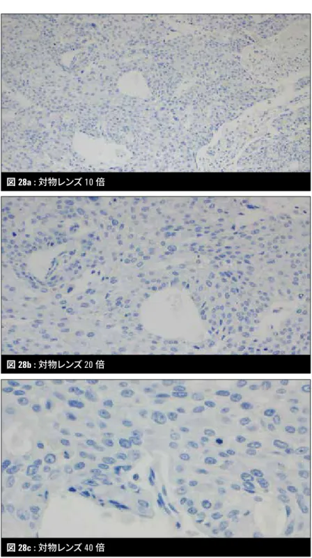 図 28a-28c : PD-L1非発現 (TPS<1%)