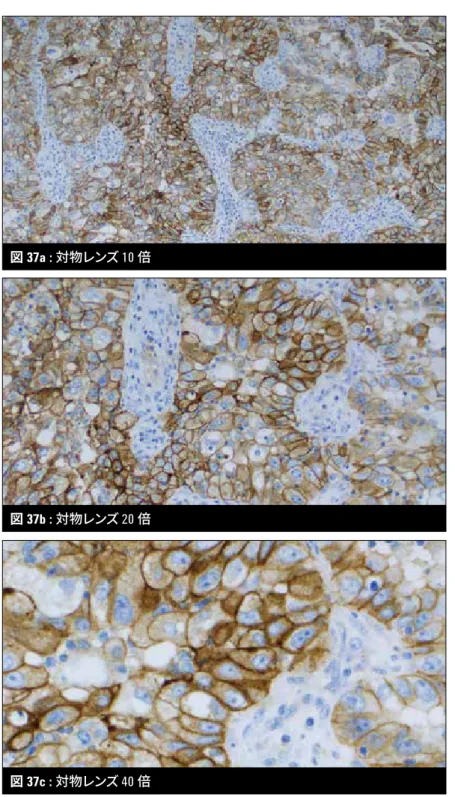 図 37a : 対物レンズ 10 倍