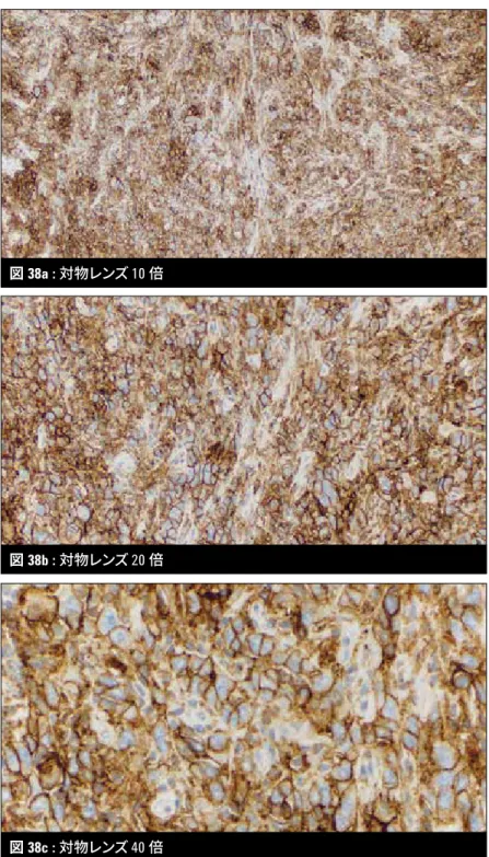 図 38b : 対物レンズ 20 倍