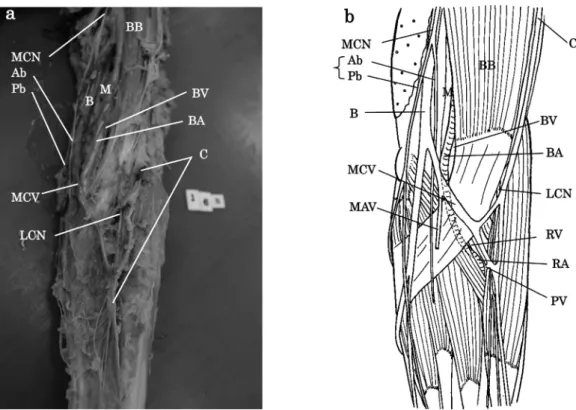 Fig. 2. Photograph (a) and drawing (b) the anterior view of left cubital fossa.