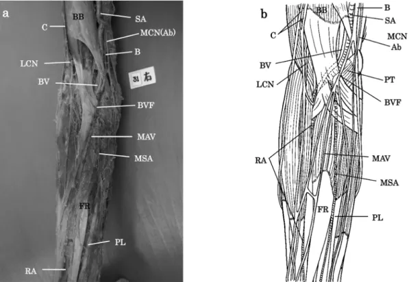 Fig. 5. Photograph (a) and drawing (b) the anterior view of the right cubital fossa and forearm.