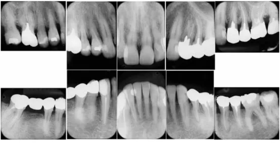 Fig.  2  Dental X-ray at first visit