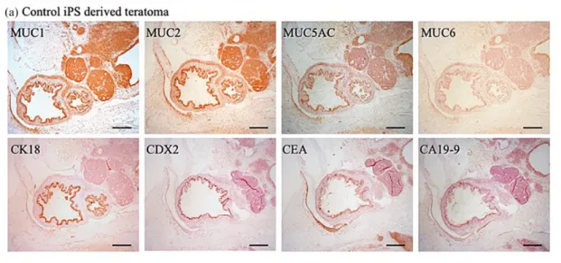 Figure 5. Immunohistochemical analysis of teratomas generated by transplantation of iPSCs into immunocompromised mice