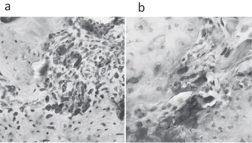 Fig. 7　Immunohistochemical staining of anti-osteocalcin （a） and TRAP  staining （b）