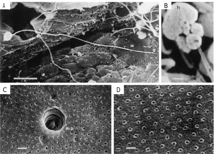 Fig. 10. Ultrastructure of spermatozoa and chorion of the bluefin tuna by scanning electron microscope (SEM)
