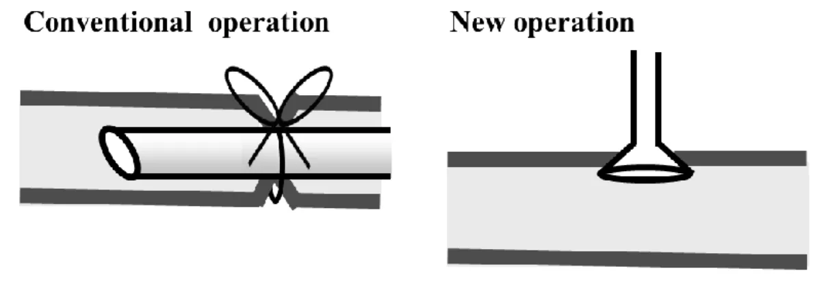 Figure 2.    Schematic diagram of the conventional operation and new operation. 