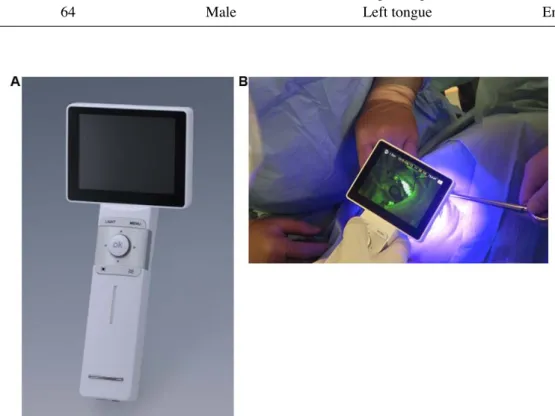 Figure 2. Principle of fluorescence visualization. Excitation light for  irradiation and wavelength of the generated fluorescence