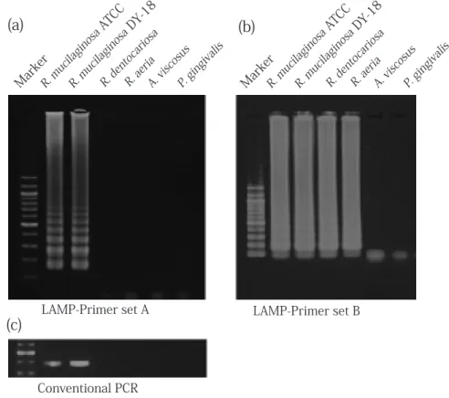 Fig. 3. Specificity of LAMP. For the specificity test, DNA templates from 22 reference strains (10 3 cells) were used as templates, and representative results are shown