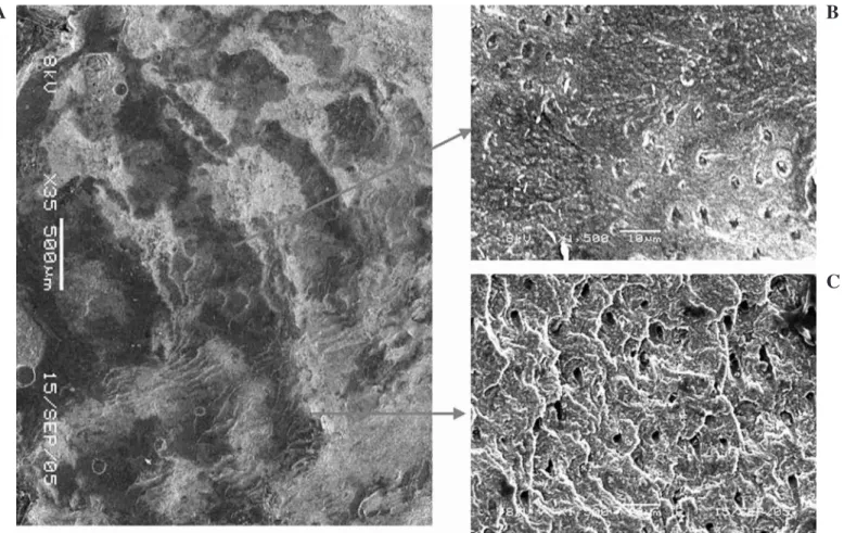 FIG. 4. SEM micrographs of the dentine side of a fractured surface from the Er:YAG lased-MB group