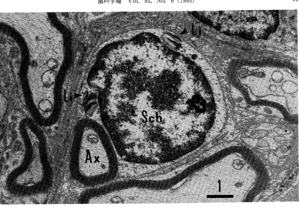 図      書羊末梢神経線維像 舶包  内にリビッド封入体  が認められる｡ × 図14 図13の拡大図 細胞内のリビッド封入体 × はSTZ投与後,早期より肥厚の発現が認められ,その 後は飼育期間の長新化による影響は少なく, N群, DM 群における加齢による基底膜の肥厚は同様の値を示すこ とから,糖尿病状態の長斯化による基底膜の厚径の増加 は少ないと考えられた｡ 基底膜厚径の分布については図21に示すようにN喪, DM群共に飼育期間に関係なく,ほぼ同様の傾向を示し た｡ N君羊, DM群共に分布のピー