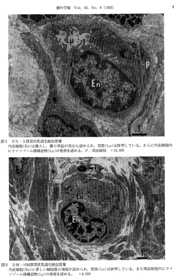 図     群茸状乳頭毛細血管像 内皮細胞  は腫大し,微小突起の突出も認められ,管腔  は狭窄している｡さらに内皮細胞内 にライソゾーム様構造物  の発現を認めるo P :周皮細胞 × 図      君羊茸状乳頭毛細血管像 内皮細胞  に著しい細胞薯の増殖が認められ,管腔  は狭窄している｡また周皮細胞内にライ ソ'jLム様構造物  の発場を認めるo X ‑ 7 ‑
