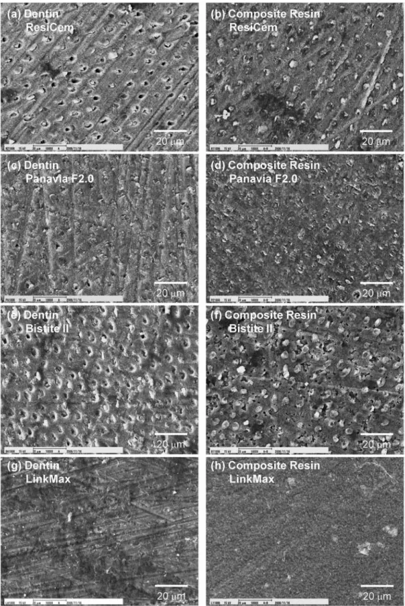 Fig. 4  Fracture  surfaces  of  bovine  dentin  and  composite  resin  after  the  shear  bonding  test