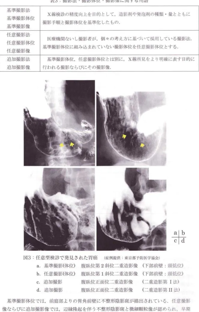 表 3: 撮 影 法 ・ 撮 影 体 位 ・ 撮 影 像 に 関 す る 川 語 図3 : 任 意 型 検診 で 発 見 され た 胃癌   ( 症 例提供 : 東 京都予 防医 学協 会) a 