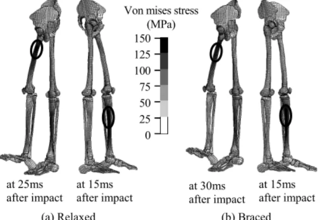 Fig. 18    Contour of stress distribution on lower extremities  at the time that maximum contact force was predicted.