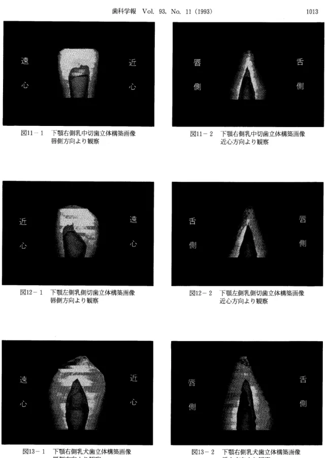 図   下顎右側乳中切歯立体構築画像 唇伽方向より観察 図    下顎左側乳側切歯立体構築画像 唇側方向より観察 図13‑ 1下顎右側乳犬歯立体構築画像 唇側方向より観察 図    下顎右側乳中切歯立体構築画像近心方向より観察図    下顎左側乳側切歯立体構築画像近心方向より観案図    下顎右価乳犬歯立体構築画像 近心方向より観察