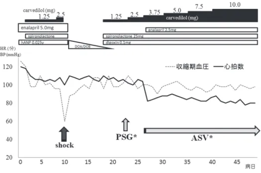 図 2　第 23 病日に施行した終夜睡眠ポリグラフ．