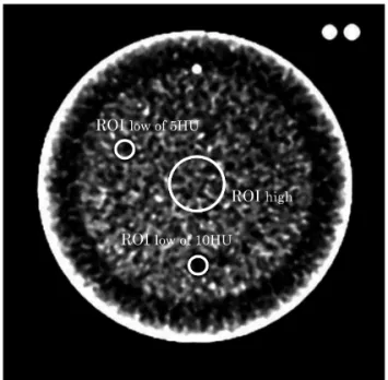 Fig. 5 Example of combination of simulated CT perfusion (CTP) images for observer study.