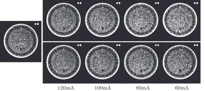 Fig. 7 The cerebral blood flow(CBF) map from varying tube currentsand each reconstruction method
