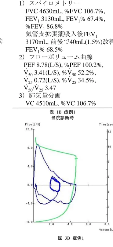表 1A  症例1 前医受診時 図 3A 症例1 表 1B  症例1当院診断時 1.  呼吸機能検査の読み方（表 1, 図 3） 前医受診時の表1では、画像で肺気腫病変がある ものの、呼吸機能検査では気管支拡張薬吸入後の1 秒率が73.9%と気流閉塞は認めない。フローボ リュームカーブでも下に凸の所見は認めないが、 V 50 /V 25 が3以上であり末梢気道での呼気気流閉塞が 疑われる。この時点では禁煙継続での経過観察と なった。以後徐々に労作時の息切れや喀痰を自覚 し始めている。 図 3B 症例1 右に