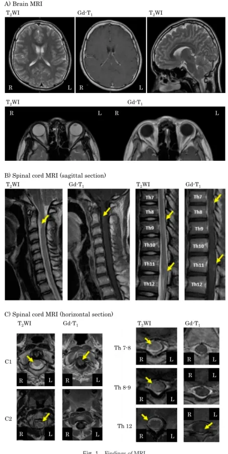 Fig. 1 Findings of MRI.