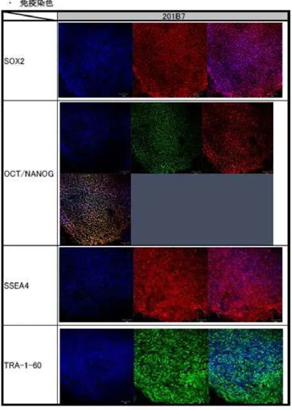 図 2.1.1-4-3  自動培養装置によるヒト iPS 細胞評価（201B7 の免疫染色） 