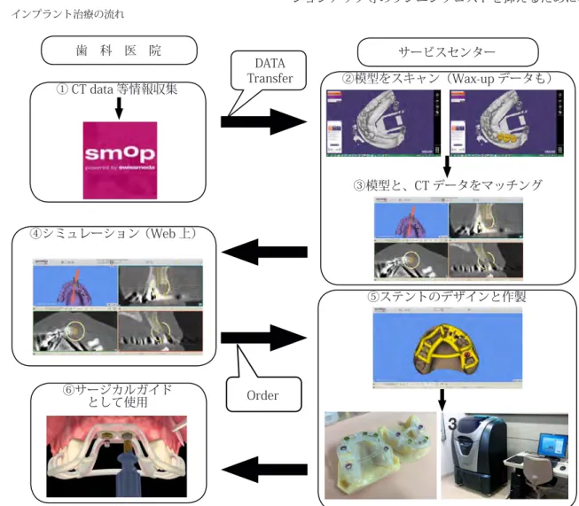 図 2　WEB 上でのシミュレーションおよびサージカルガイド作製システム（SMOP: Alta-Dent 社製）