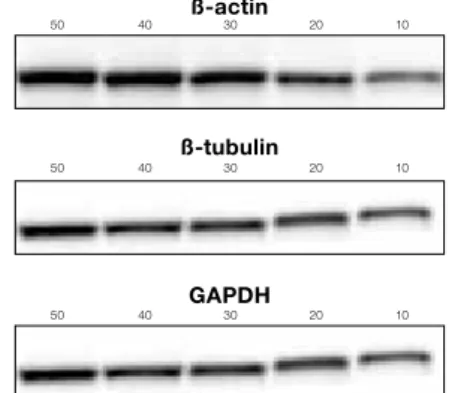 図 15   Stain-Free を用いた、 膜 上 タンパク質の検出 HeLa細胞ライセートを50μg~10μgの希釈 系列をCriterion TGX Stain-Freeゲルで泳動し、 泳動後に1分間UVを照射。その後、トランス ブロットTurboを用いニトロセルロース膜に7 分間転写。転写後の膜にUVを照射し、ブロッ トイメージを得た。