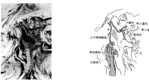 図   上行咽頭動脈后桃枝(標本番号180左札 内側面 93歳女性) 図18‑ 1顔面動脈后桃枝(標本番号240右酢 外側面 78歳女性) 発育がまちまちで茎突咽頭筋との区別のはっきりしない 筋束がみられたからである｡ の報吾における筋束を貫くもの,茎突舌筋 と茎突咽頭筋の間および茎突咽頭筋の深層を経過するも のを総て茎突舌筋の深層を経過するものとすれば,その 塵度は59例   となり筆者の浅層経過  深層60% とほぼ同頻度となる｡ 上行口蓋動脈が顔面動脈より分かれる場合には外頚動 脈より分かれる場合に比