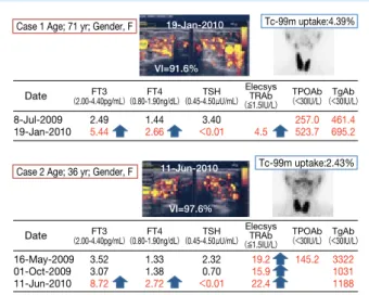 図 8：Comparison  of  age  distribution  in （A） GD  patients following Hashimoto’s thyroiditis  and （B） GD  patients at initial presentation