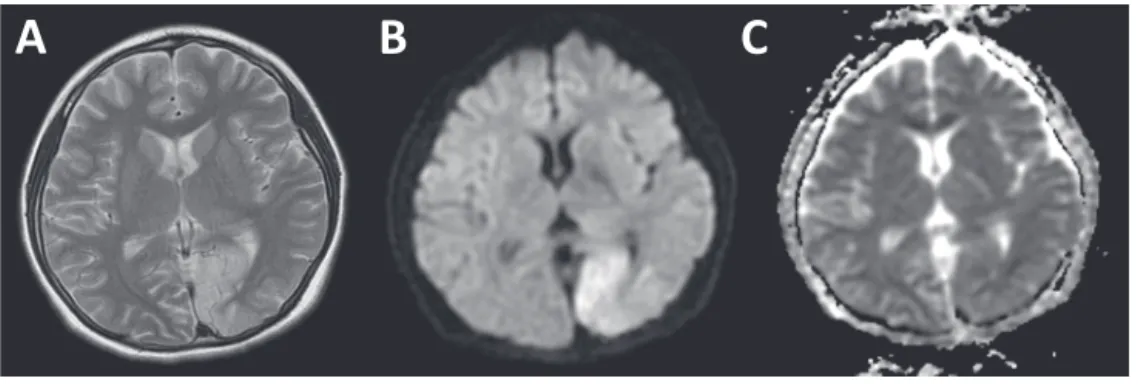 Fig. 2　Clinical course during the admission at age 14.
