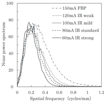 Fig. 5  NPS of the optimized IR ﬁlter type.