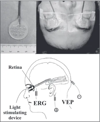 Fig.  1　upper  left:  Our  light-stimulating  device  contains  16  red  high-power  LEDs  (100  mCd)  embedded  in  a  2-cm  diameter  soft  silicone  disc.