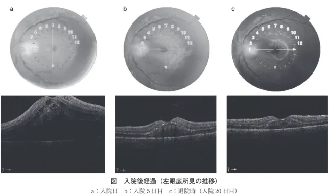 表 2 血清 B. henselae IgM・IgG 抗体価（IFA 法）