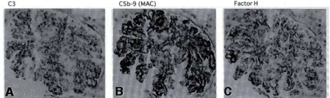 Fig. 2 Competitive deposition between C5b-9 (MAC) and Factor H on glomerular epithlium during complement activation 18) .