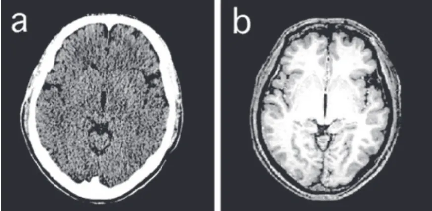 Figure 1.  Comparison between X-ray CT and MRI images. (a) X-ray CT image. (b) MRI image (T1-weighted image).